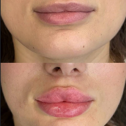 Labios